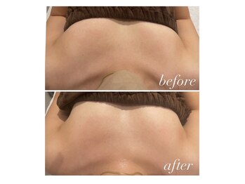 オークツリー(oak tree)/ぷるんぷるんバストケア