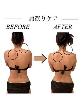 ファミーユ 新宿店/【肩凝り】ビフォーアフター