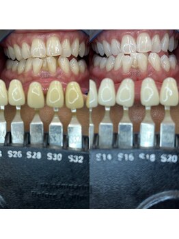 トウキョウスワーズ 池袋店(TOKYO SWRS)/#ホワイトニング #池袋 #渋谷