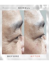 ホワイトアクア 福岡天神店(WHITE AQUA)/韓国の女医が開発したララピール