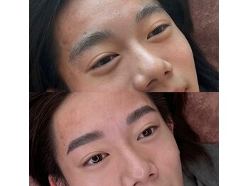 ウミ(Ummi)/学生HBL