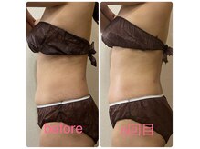 アロマタミィー(Aroma tammy)の雰囲気（キャビテーション＆ラジオ波でむくみ改善！痩せやすい身体作りに）