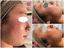 サロン デ ミロ(Salon de Miro)/BeforeAfter多数！ブログへGO♪