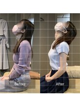 ナオル整体 仙台院(NAORU整体)/首の痛み