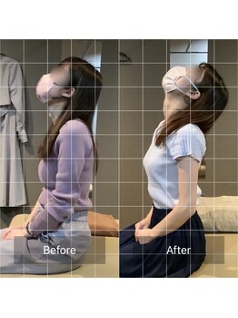 ナオル整体 仙台院(NAORU整体)/首の痛み