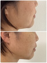 トリートメントルーム フェリーチェ(Felice)/９０分後「痩せた?」と笑顔に