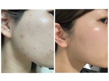 エイジングケア最上級！！艶玉肌セルマン