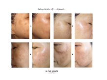 マベール/Dr.PUR &nbsp;BEAUTE お客様結果