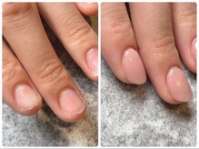 ココネイル(coco.nail)の雰囲気（傷んだ自爪の状態に応じた施術で、見た目も痛みも解消できます）