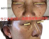 ヨウジョウアン(YOJOU UN)