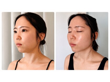 ハーブピーリング 小顔 痩身専門店 salon perleの写真