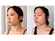 ハーブピーリング 小顔 痩身専門店 salon perleの写真