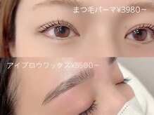 ビアス(VIAS)