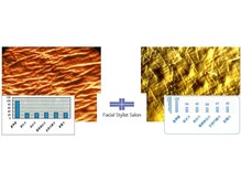 フェイシャルスタイリストサロン 高崎店(Facial Stylist Salon)/キメのケア例（3）