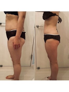 メゾン アンジュ(Maison Ange)/【ダイエットコース3回目】