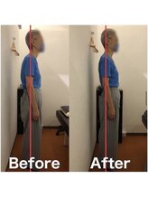 カワル整体 上通り院/【肩と頭が辛いです…】