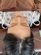 ハリファ鍼灸院 横浜関内院(HariFa鍼灸院)/美容施術