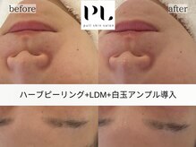 プル スキンサロン(pull skin salon)/