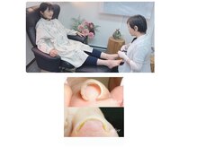 フットグッド 華乃叶(FootGood)の雰囲気（足裏の角質ケア・当社考案の特許取得器具であらゆる巻き爪も改善）