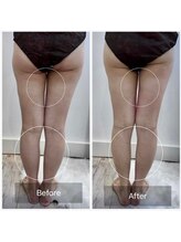 ウィズ ユー ビューティ(with U beauty)/隙間出現