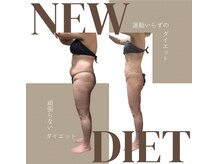 サロンド ヴィーナス 葛西店/-12Kｇ全身本気痩せも応援