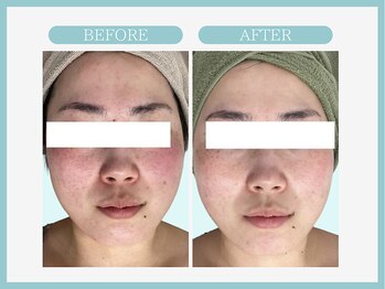 スリムライン 弘前店(The Slim Line)/before→after