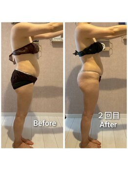 エミア(Emia)/全身痩せ×歪み改善◎120分 ２回