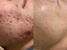 ライブリー(LIVELY)/