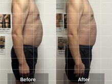 インナーメス(INNER MES)/変化でやすいお腹