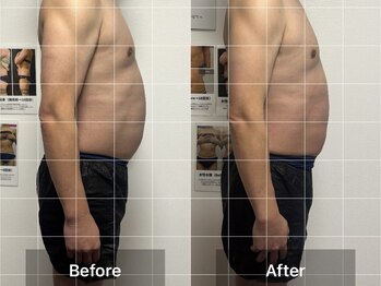 インナーメス(INNER MES)/変化でやすいお腹