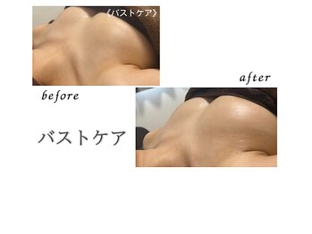 リリー(Lily)/バスト