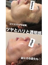 ジュネラ ボーテ(Jenela beaute)/ツヤハリ変化