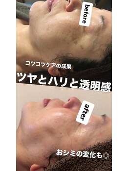 ジュネラ ボーテ(Jenela beaute)/ツヤハリ変化