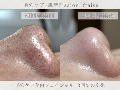 フレーズ(fraise)の写真