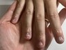 キッズ育成ネイルケア｜噛み癖・むしり癖ケア