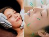 【小顔・むくみに◎】美顔鍼×お顔筋膜ケア120分