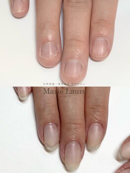 マリーロール 梅田店(Marie Laure)/自爪育成/深爪矯正/ネイルケア
