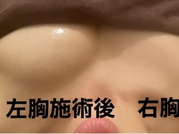 ローズボディ 恵比寿店/小顔キャビバストアップ整体