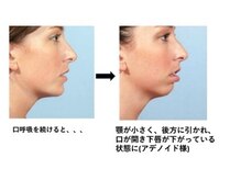 オズ六本木/口呼吸にはご注意＠小顔六本木