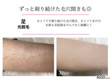 アルゴ 熊本健軍店(ALGO)/毛穴まで綺麗に◎