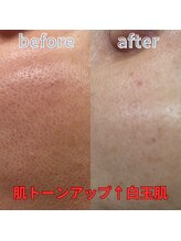 グロワール(gloire)/再生美容(ビフォーアフター)