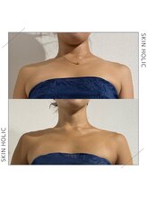 スキンホリック 恵比寿駅前店(SKIN HOLIC)/デコルテ美人！