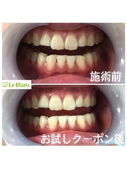 ルブラン 奈良店(Le Blanc)/学生さんにも