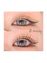 アンドアイディール 町田店(&Eyedeal.)/before/after　Lカール