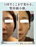 【小顔/むくみ/食いしばり】小顔矯正/黄金比小顔体験クーポン