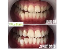 ルブラン 奈良店(Le Blanc)/お試しで効果体感できます！
