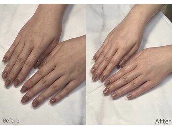 レアノアネイル(Leano'a Nail)/beforeafter