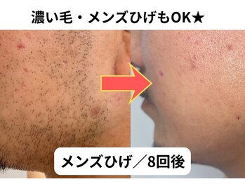 NTエステティック 西条店/