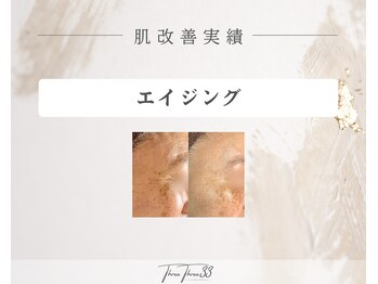スリースリー 恵比寿(THREE THREE)/エイジングケア 改善実績写真