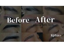 ケープラス(K Plus+)/before after